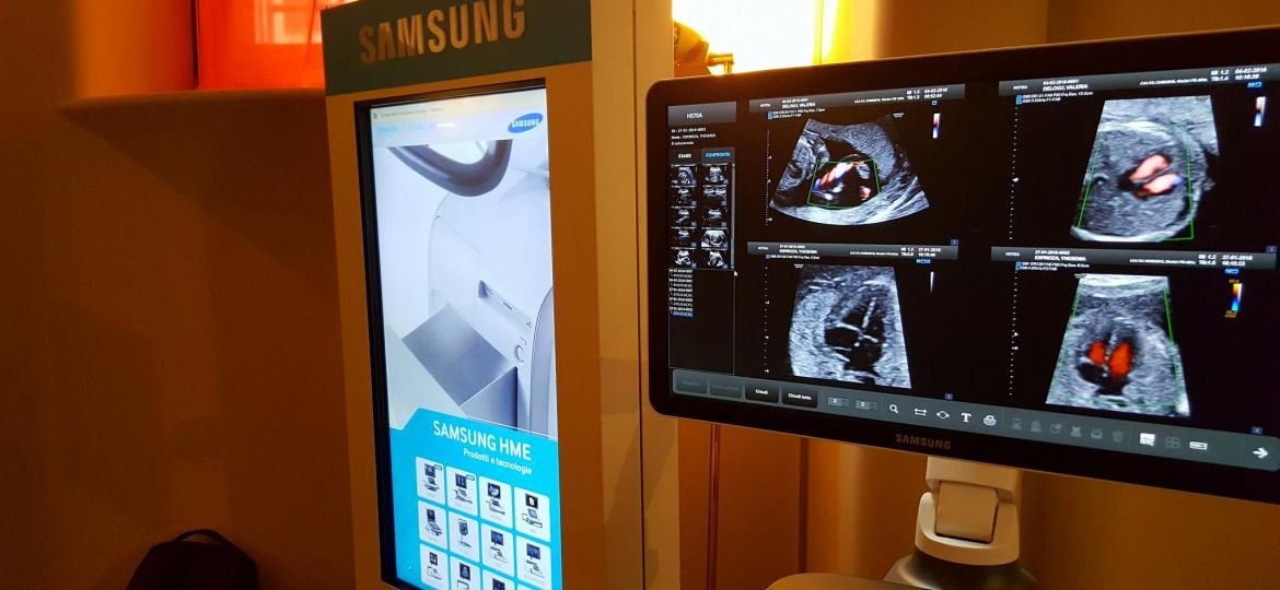 ecografi samsung samsung medical italy italia