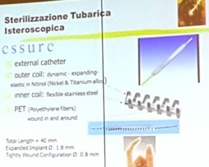 essure cremascoli isteroscopia